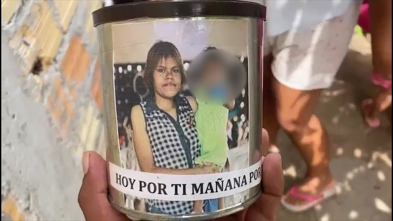 Tarapoto Joven De A Os Podr A Sufrir La Amputaci N De Una Mano Tras